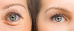 Enlever les cernes sous les yeux