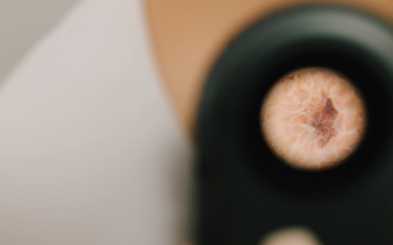 l'IA et le dépistage des cancers de la peau